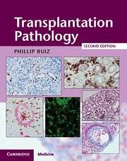 Transplantation Pathology Hardback with Online Resource