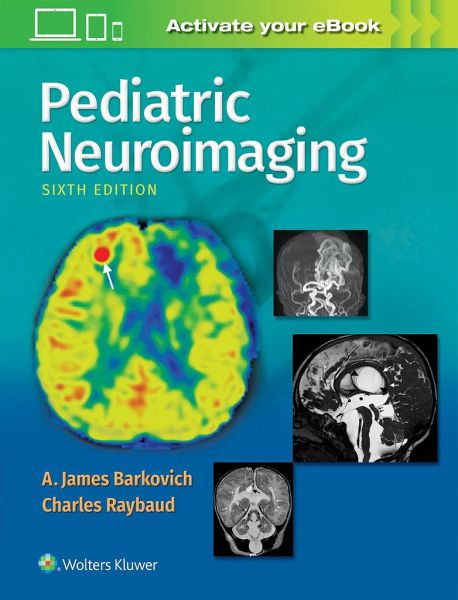 Pediatric Neuroimaging von Barkovich, A. James, MD; Charles Raybaud ...