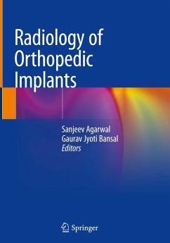 Radiology of Orthopedic Implants