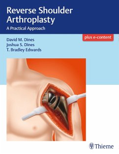 Reverse Shoulder Arthroplasty (eBook, PDF) - Dines, David M.; Dines, Joshua; Edwards, T Bradley