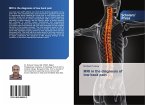 MRI in the diagnosis of low back pain