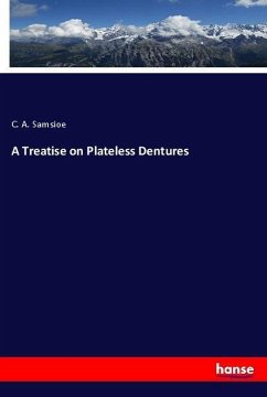 A Treatise on Plateless Dentures - Samsioe, C. A.