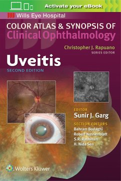 Uveitis (Color Atlas and Synopsis of Clinical Ophthalmology) - Garg, Sunir