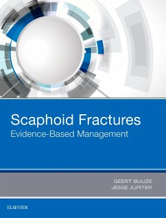 Scaphoid Fractures (eBook, ePUB) - Buijze, Geert Alexander; Jupiter, Jesse B.