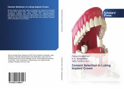 Cement Selection in Luting Implant Crown - Khan, Parvez Ahmad;Azhagarasan, N. S.