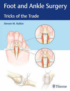 Foot and Ankle Surgery (eBook, PDF) - Raikin, Steven M.