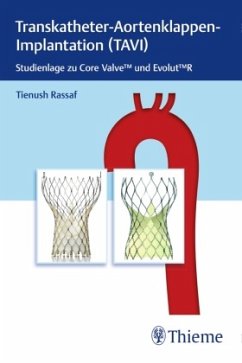 Transkatheter Aortenklappenimplantation (TAVI) - Rassaf, Tienush