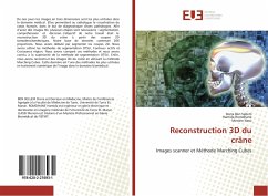 Reconstruction 3D du crâne - Ben Sellem, Dorra;Romdhane, Hamida;Jlassi, Meriem
