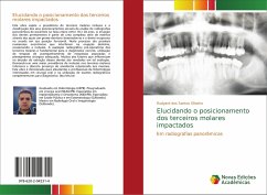 Elucidando o posicionamento dos terceiros molares impactados - dos Santos Oliveira, Rudyard