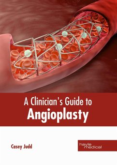 A Clinician's Guide to Angioplasty