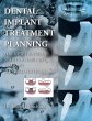 Dental Implant Treatment Planning for... - Bild 1