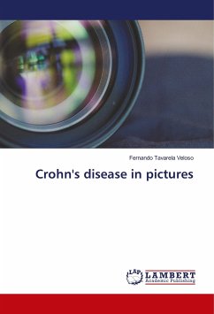 Crohn's disease in pictures - Veloso, Fernando Tavarela