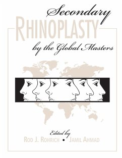 Secondary Rhinoplasty by the Global Masters (eBook, PDF) - Rohrich, Rod; Ahmad, Jamil
