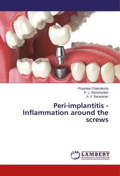 Peri-implantitis - Inflammation around the screws