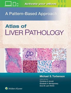 Atlas of Liver Pathology: A Pattern-Based Approach - Torbenson, Michael, MD