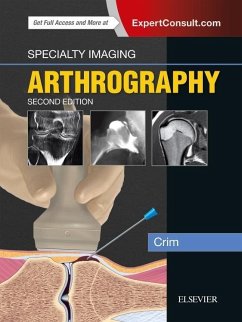 Specialty Imaging: Arthrography - Crim, Julia R.
