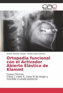 Ortopedia funcional con el Activador Abierto Elástico de Klammt - Alcauter Zavala, Andrés;Ayala Zarazua, Maribel