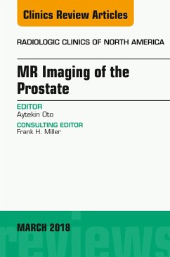 MR Imaging of the Prostate, An Issue of Radiologic Clinics of North America (eBook, ePUB) - Oto, Aytekin