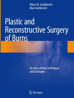 Plastic and Reconstructive Surgery of Burns - Grishkevich, Viktor M.;Grishkevich, Max