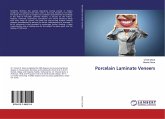 Porcelain Laminate Veneers