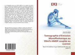 Tomographie d¿Emission MonoPhotonique au 99mTc-HMDP couplée au scanner - Ben Sellem, Dorra;Weslati, Ferdaoues