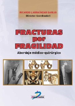 Fractura por fragilidad : abordaje médico quirúrgico - Larraínzar Garijo, Ricardo