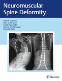 Neuromuscular Spine Deformity (eBook, ePUB)