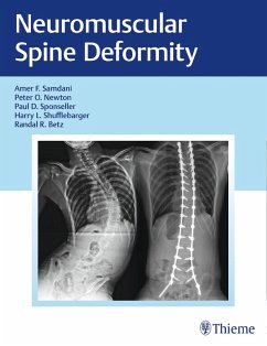 Cover Neuromuscular Spine Deformity (eBook, PDF)