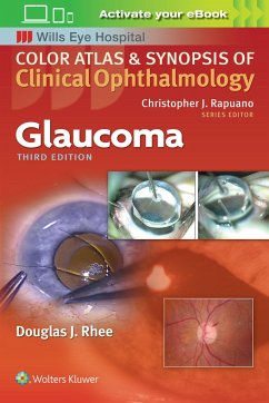 Glaucoma (Color Atlas and Synopsis of Clinical Ophthalmology) - Rhee, Douglas