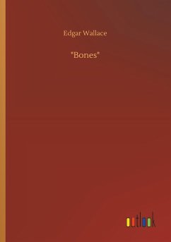 "Bones"