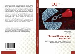 Physiopathogénie des métastases - Hanène, Smadhi;Sana, Khaldi;Ahmed, Rejeb