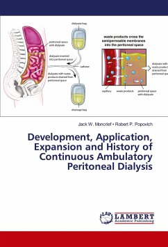 Development, Application, Expansion and History of Continuous Ambulatory Peritoneal Dialysis