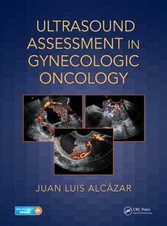 Ultrasound Assessment in Gynecologic Oncology - Alcazar, Juan Luis (University of Navarra, Pamplona, Spain)