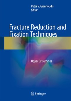 Fracture Reduction and Fixation Techniques (eBook, PDF)