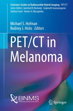 PET/CT in Melanoma (eBook, PDF)
