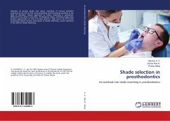 Shade selection in prosthodontics