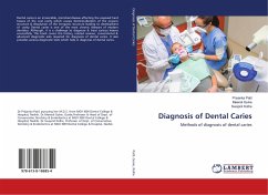 Diagnosis of Dental Caries - Patil, Priyanka;Gulve, Meenal;Kolhe, Swapnil