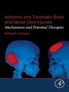 Ischemic and Traumatic Brain and Spinal Cord Injuries (eBook, ePUB) - Farooqui, Akhlaq A.