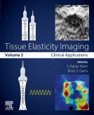 Tissue Elasticity Imaging (eBook, ePUB)