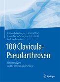100 Clavicula-Pseudarthrosen (eBook, PDF)