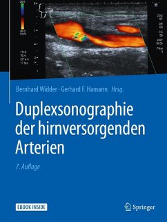 Duplexsonographie der hirnversorgenden Arterien (eBook, PDF)