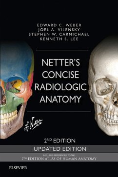 Netter's Concise Radiologic Anatomy Updated Edition E-Book (eBook, ePUB) - Weber, Edward C.; Vilensky, Joel A.; Carmichael, Stephen W.