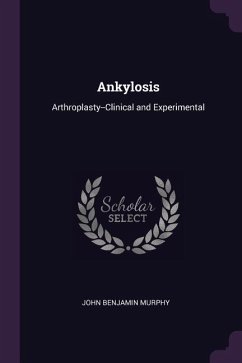 Ankylosis