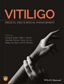 Vitiligo (eBook, ePUB)