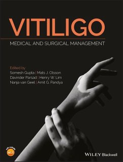 Vitiligo (eBook, ePUB)