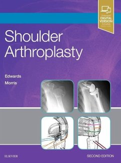 Shoulder Arthroplasty - Edwards, T. Bradley;Morris, Brent J.