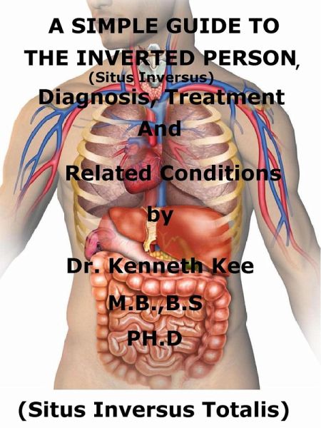 A Simple Guide To The Inverted Person, (Situs Inversus) Diagnosis, Treatment And Related Conditions (eBook, ePUB)