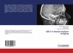 CBCT In Dental Implant Imaging