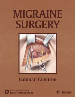 Migraine Surgery (eBook, PDF) - Guyuron, Bahman