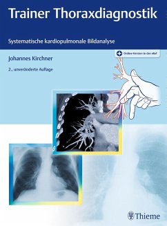 Trainer Thoraxdiagnostik (eBook, PDF) - Kirchner, Johannes